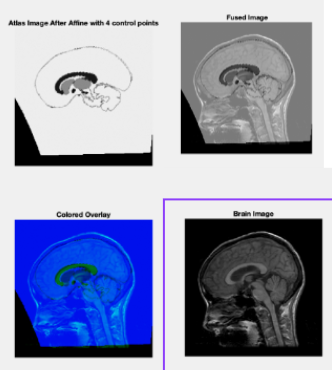 Image Registration in MATLAB